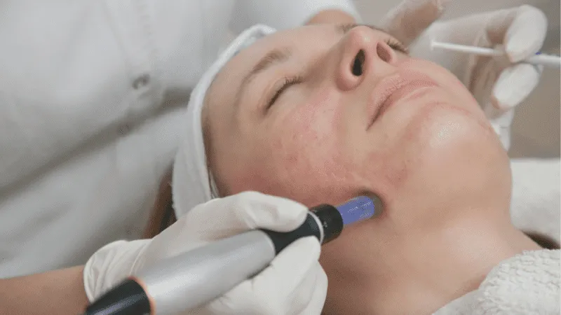 The ReNueva Facelift™